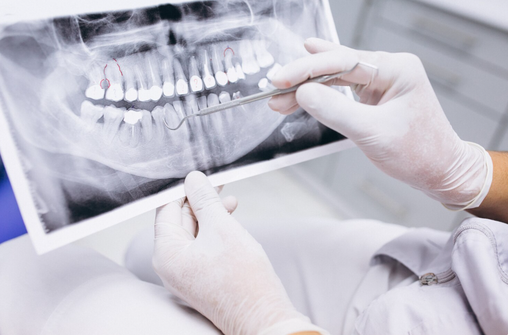 Endodoncia en Valladolid
